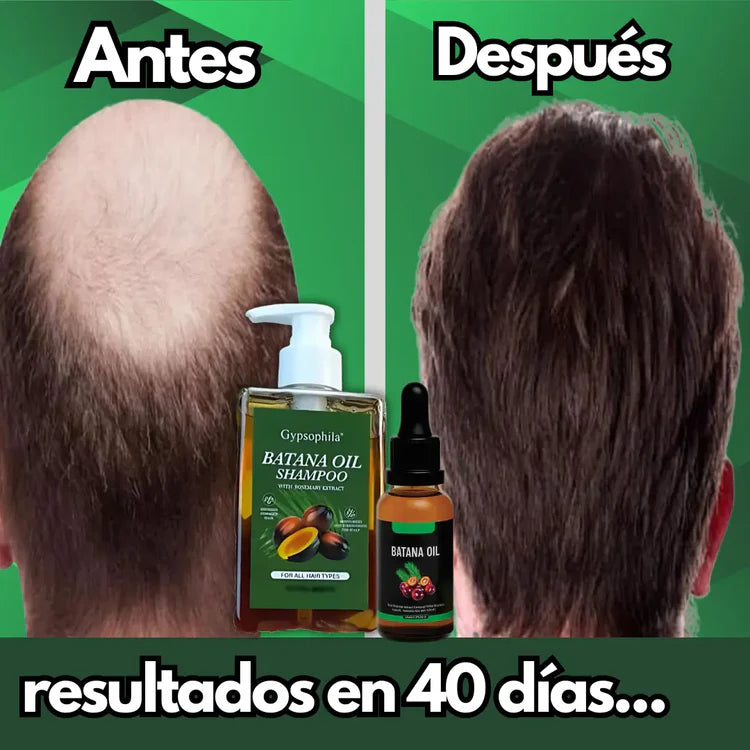 Shampoo batana™️250ml + aceite batana®️ 15ml ¡gratis!